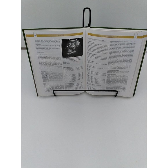 hearth and hand magnolia Metal Easel Powder Coated Finish - Picture 2 of 4